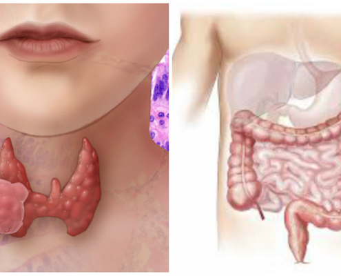 tiroide e microbiota intestinale